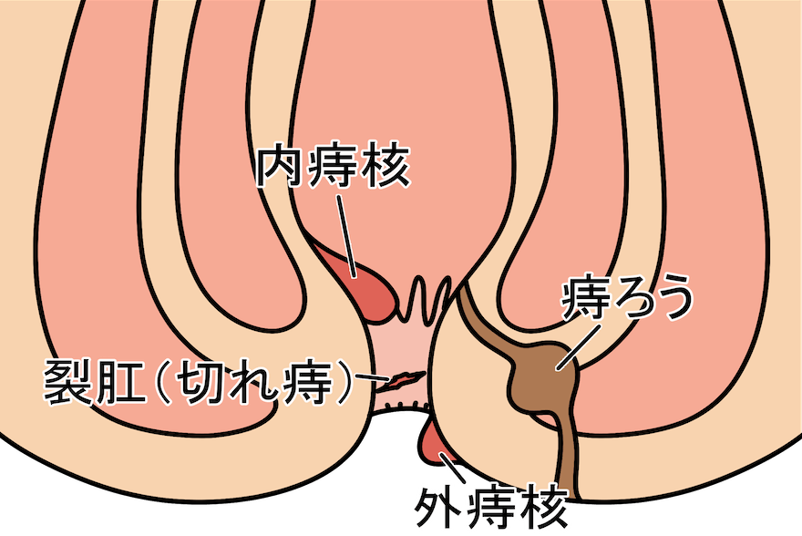 肛門のイラスト